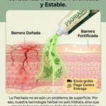 ✅ PSORIASIS™ |  Alivia la picazón y el enrojecimiento de la piel desde la primera aplicación ☀️