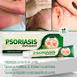 ✅ PSORIASIS™ |  Alivia la picazón y el enrojecimiento de la piel desde la primera aplicación ☀️